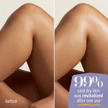 Before| 99% said dry skin was revitalized after one use Delícia Drench Body Butter | Sol de Janeiro